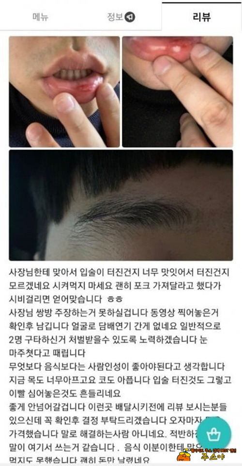 덜 쳐 맞았네~ㅎ