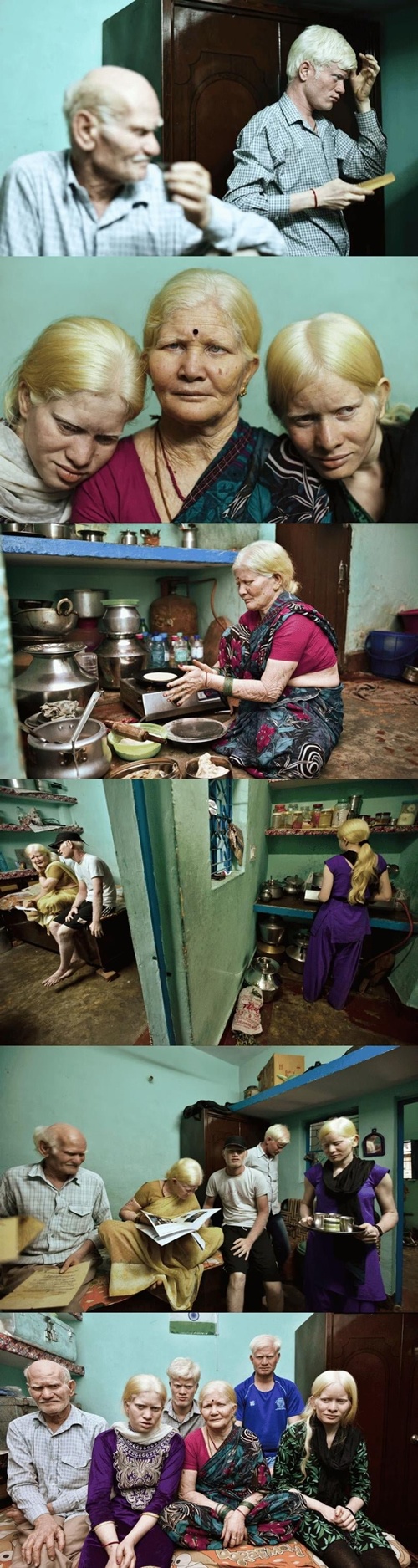 인도에 산다는 백색증 가족